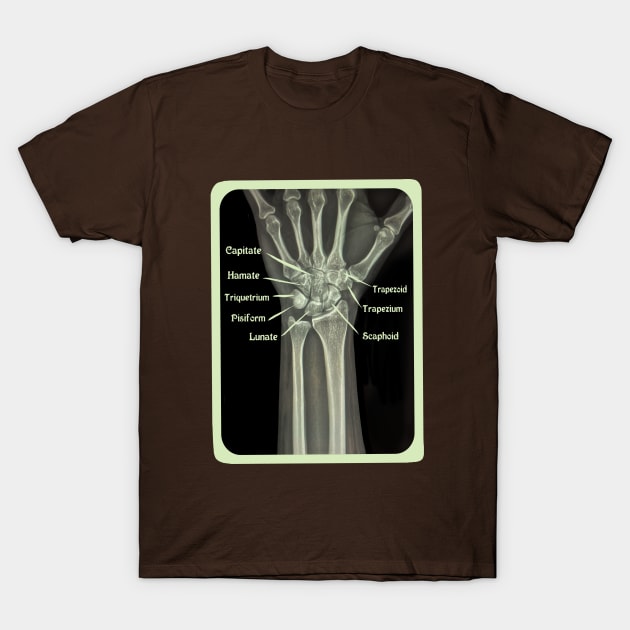 XRAY of Carpal Bones Mixed Media T-Shirt by ckrickett